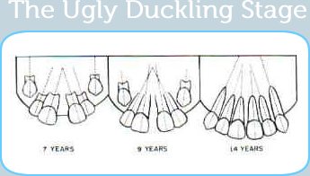 ugly duckling diagram